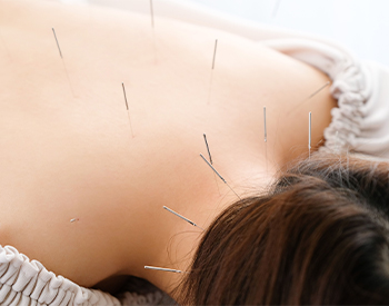 Acupuncture Treatments to Relieve Neck pain Longwood, FL