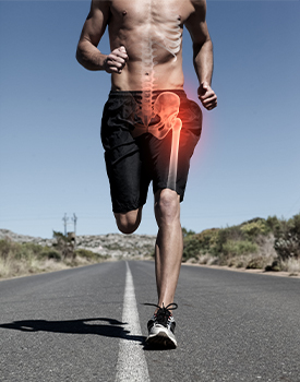 Common Hip Injuries and Conditions Altamonte Springs, FL