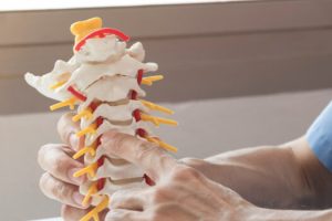 Common Misconceptions About Chiropractic Medicine Casselberry, FL
