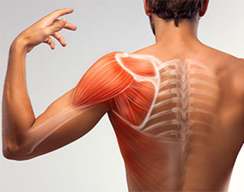 Common Shoulder Injuries and Conditions Altamonte Springs, FL